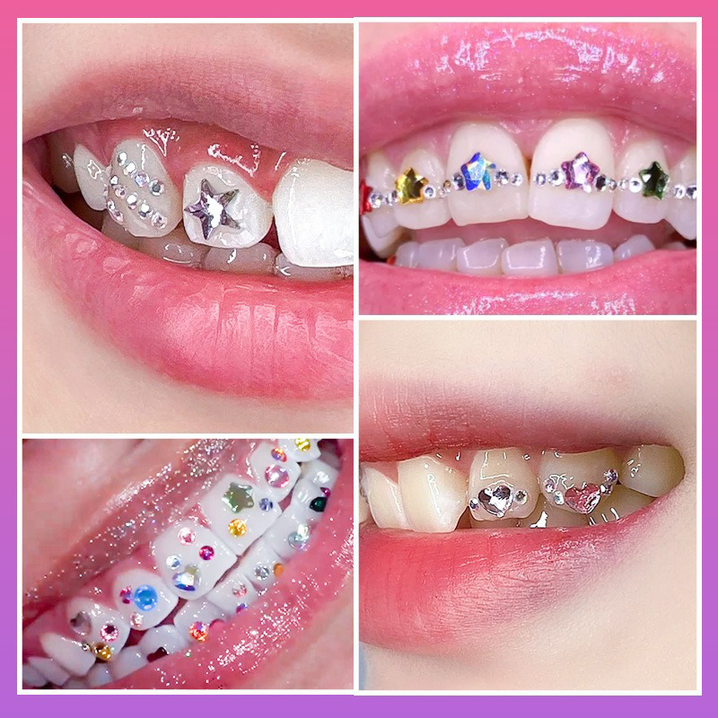 طقم جديد احترافي لتزيين الأسنا - مراجعة Tooth Gem Kit وسعره