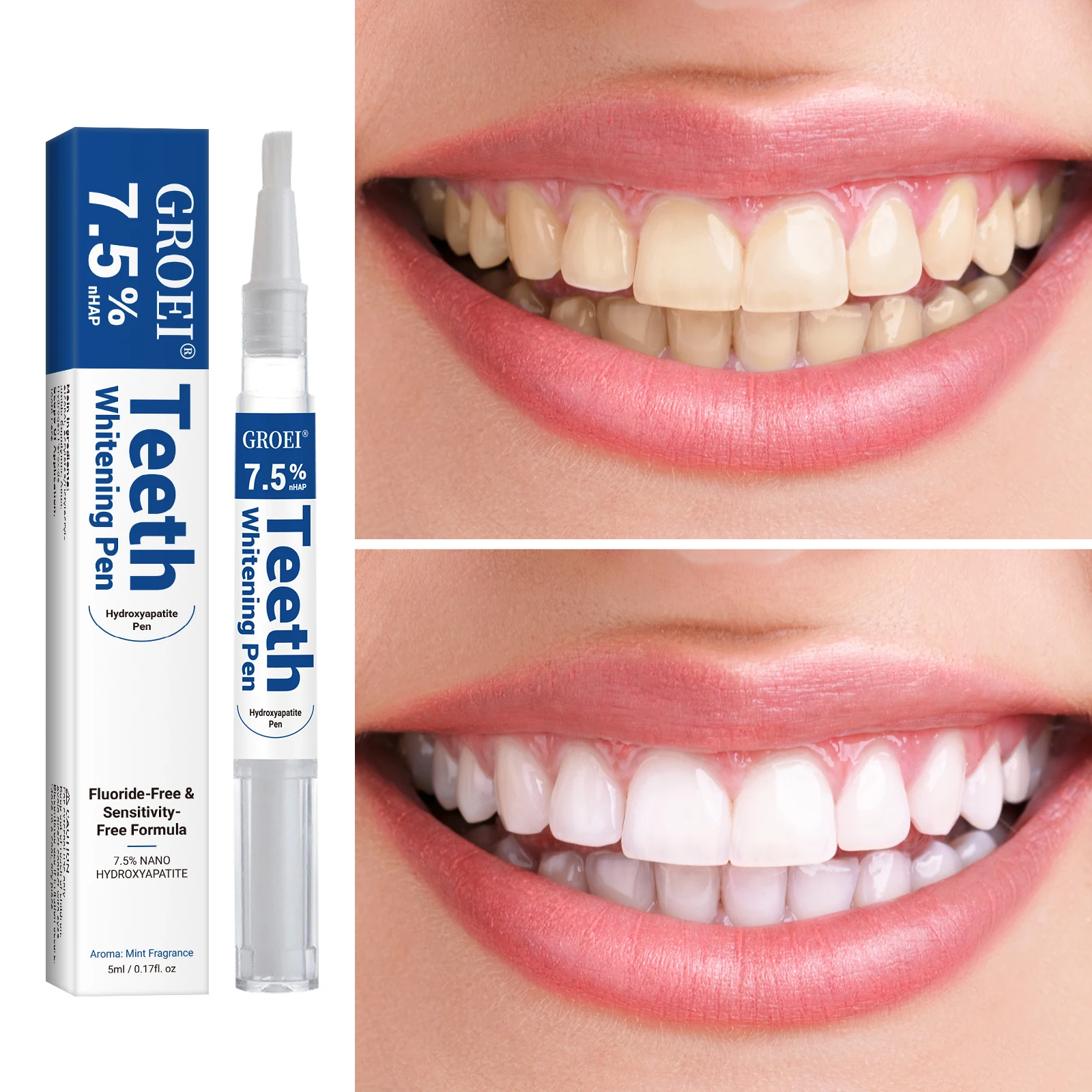هيدروكسياباتيت تبييض الأسنان ا - مراجعة Teeth Whitening Essence وسعره