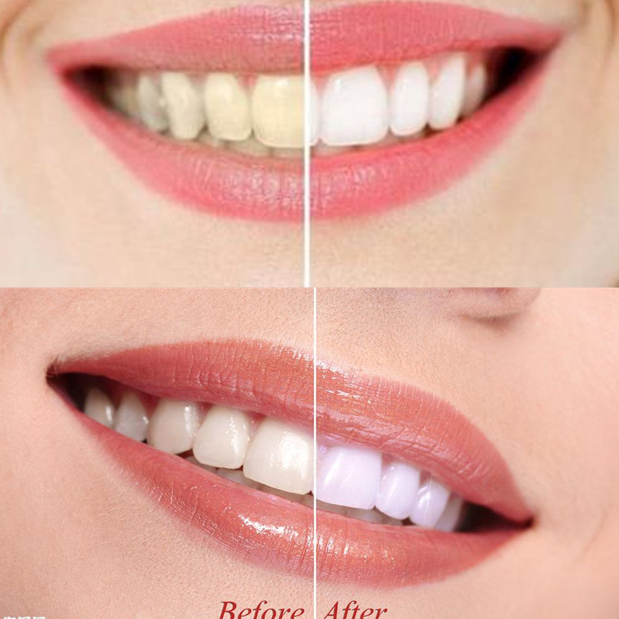 الخيزران الفحم الأسنان الأسنان - مراجعة Teeth Whitening Powder وسعره