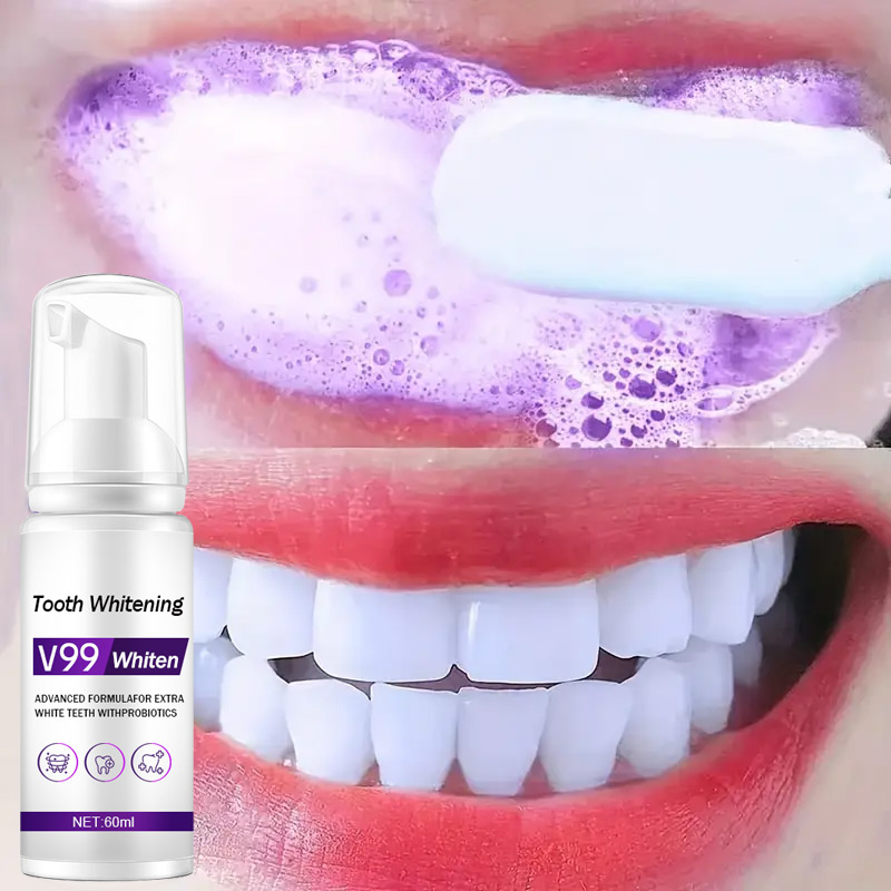 معجون أسنان موس V99، معجون أسن - مراجعة Teeth Whitening Mousse وسعره