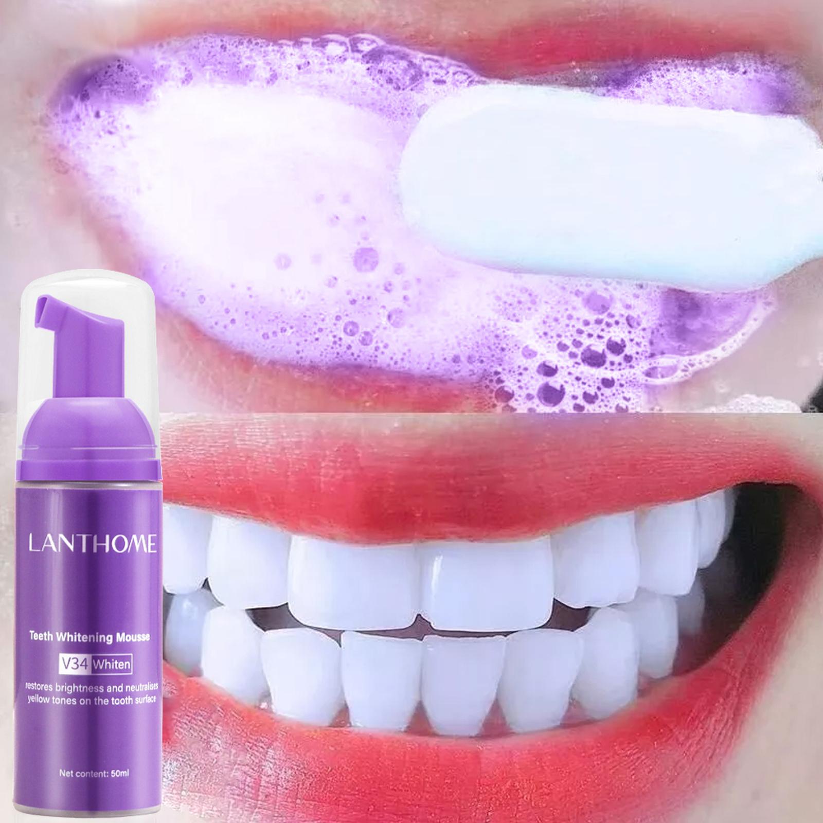 معجون أسنان V34 موس لتنظيف الأ - مراجعة Teeth Whitening Mousse وسعره