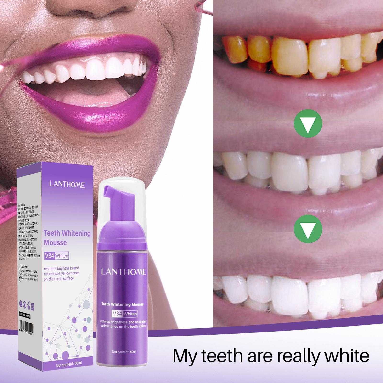 معجون أسنان V34 موس لتنظيف الأ - مراجعة Teeth Whitening Mousse وسعره