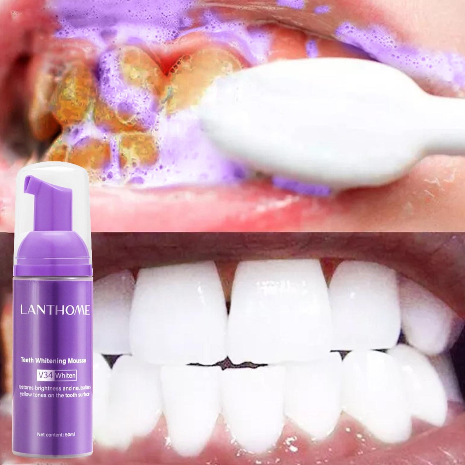 معجون أسنان V34 موس لتنظيف الأ - مراجعة Teeth Whitening Mousse وسعره