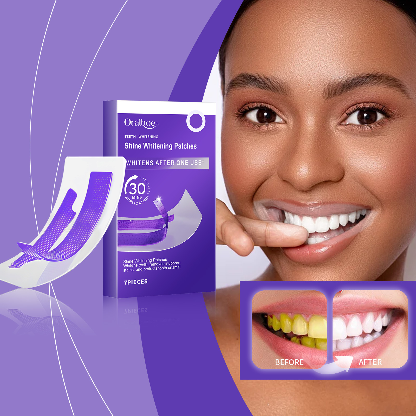 شرائط تبييض الأسنان باللون الأ - مراجعة Teeth Whitening Street وسعره