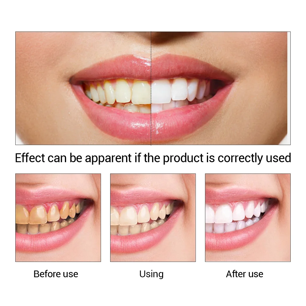 Fteenly تبييض الأسنان جوهر مسح - مراجعة Teeth Whitening Lab وسعره