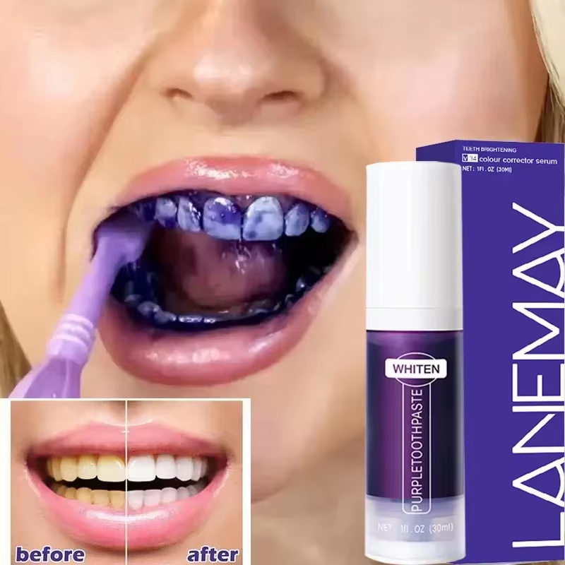 V34 معجون أسنان مبيض الأسنان ا - مراجعة Teeth Whitening Mousse وسعره