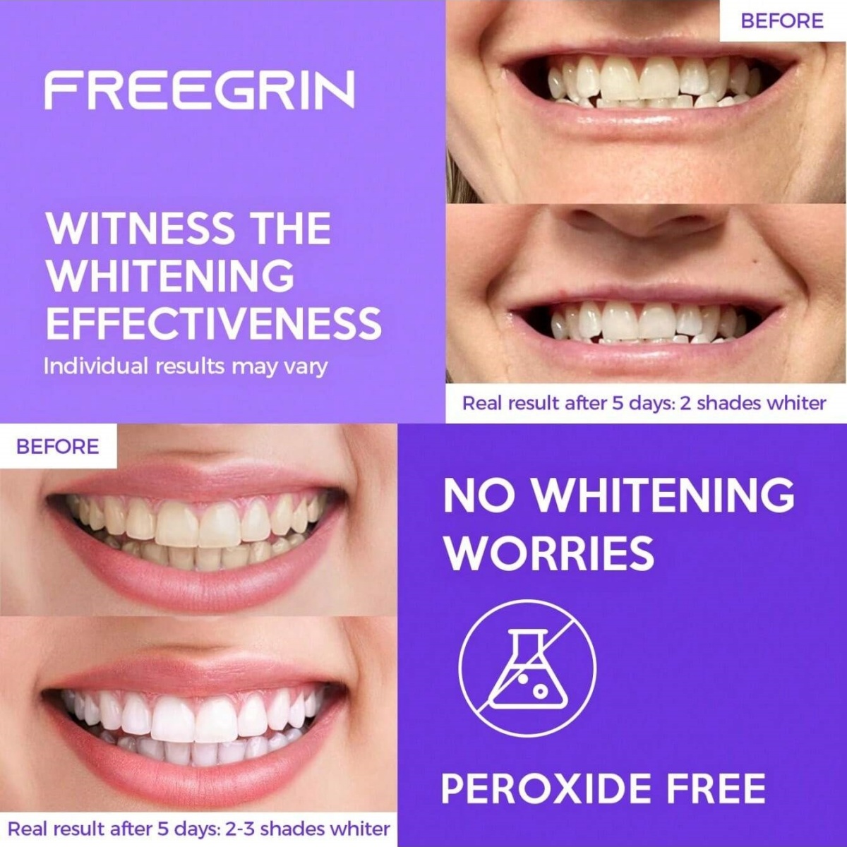 ديلوكس تبييض الأسنان ملصقات 7/ - مراجعة Teeth Whitening Street وسعره