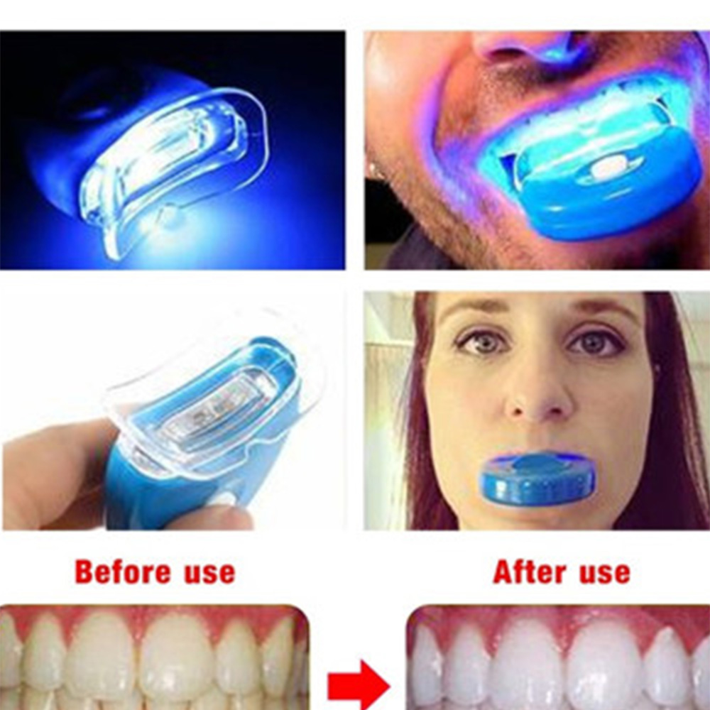 جديد الأزرق Led تبييض الأسنان  - مراجعة Teeth Whitening Uv Light وسعره