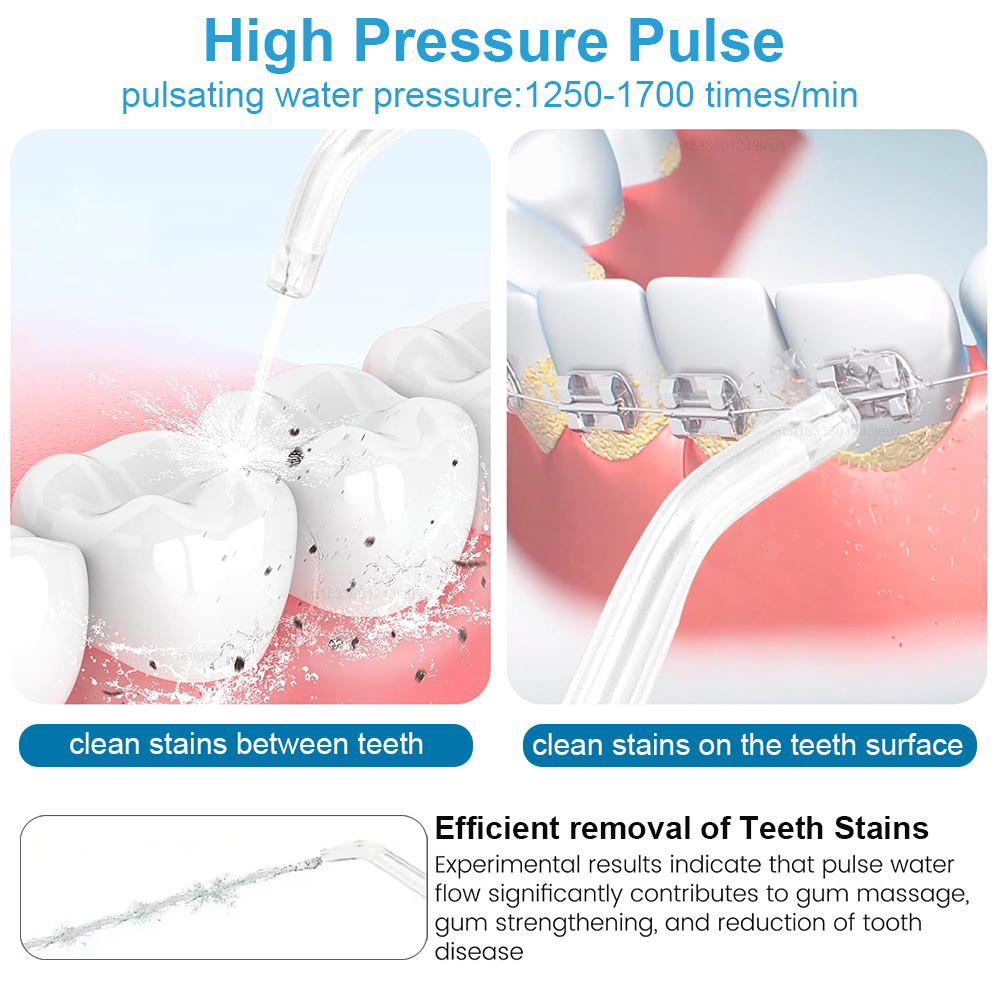 جهاز تنظيف الأسنان بالماء الكه - مراجعة Water Flosser Cordless وسعره
