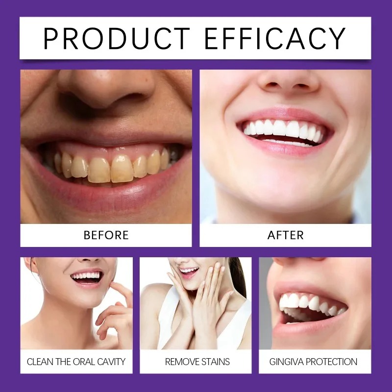 مسحوق معدني لتلميع الأسنان بال - مراجعة Teeth Whitening Powder وسعره
