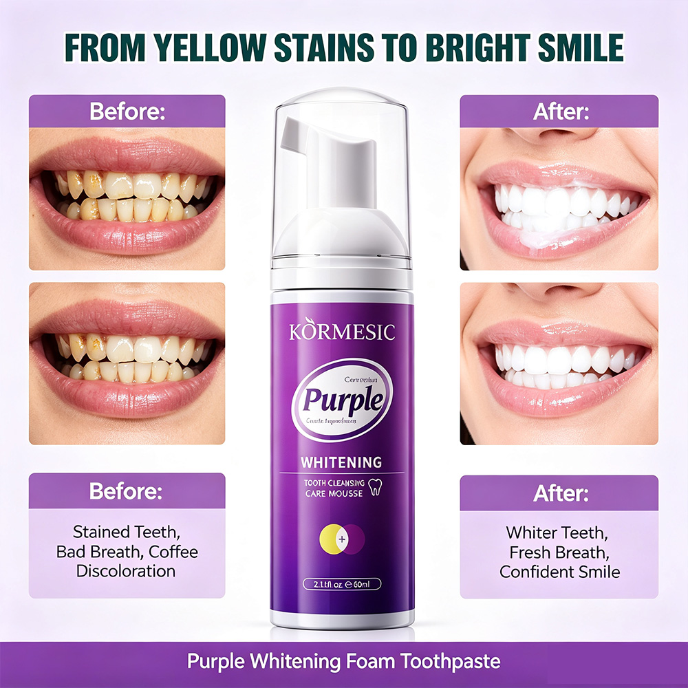 رغوة تبييض الأسنان البنفسجية V - مراجعة Teeth Whitening Mousse وسعره